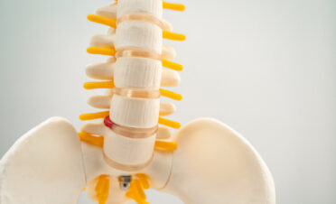 Basi-vertebral nervablation
