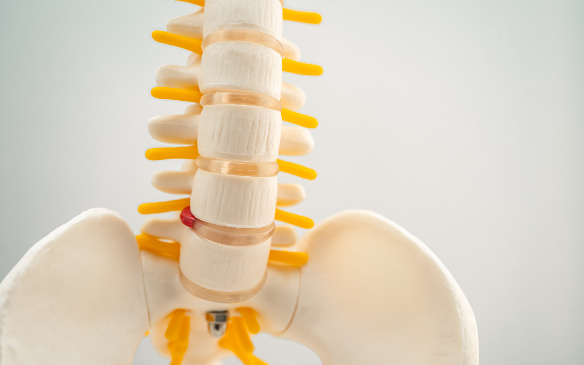 Basi-vertebral nervablation blog